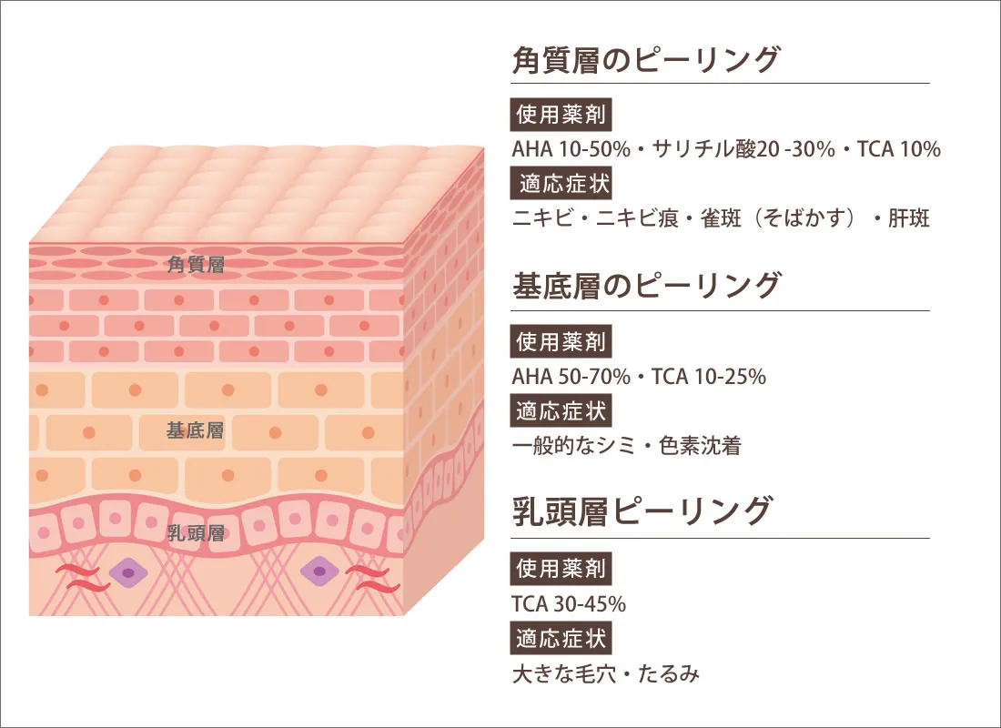 TCA(トリクロロ酢酸)ピーリング